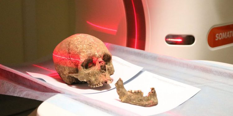 скелет історія