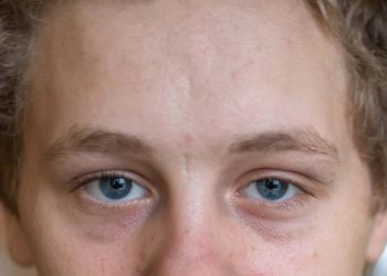 Шістнадцятирічний підліток вижив під час смертоносного обстрілу Бахмута