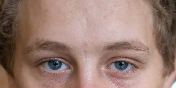 Шістнадцятирічний підліток вижив під час смертоносного обстрілу Бахмута