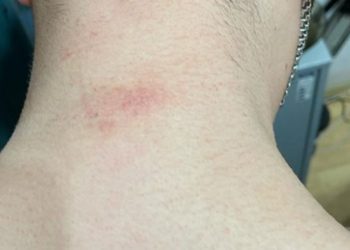 Тернопільські правоохоронці вибивали покази у підозрюваного