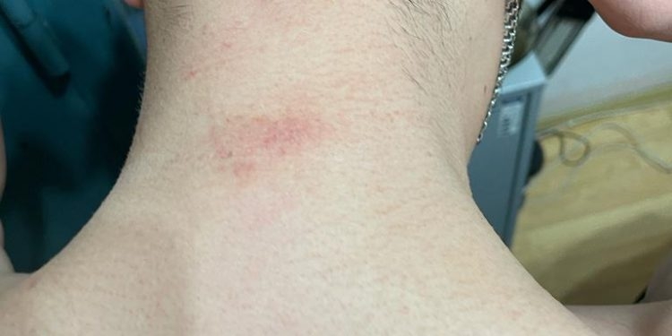 Тернопільські правоохоронці вибивали покази у підозрюваного