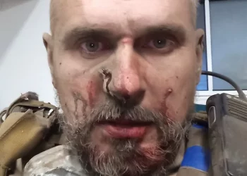 Олег Сенцов отримав поранення на фронті