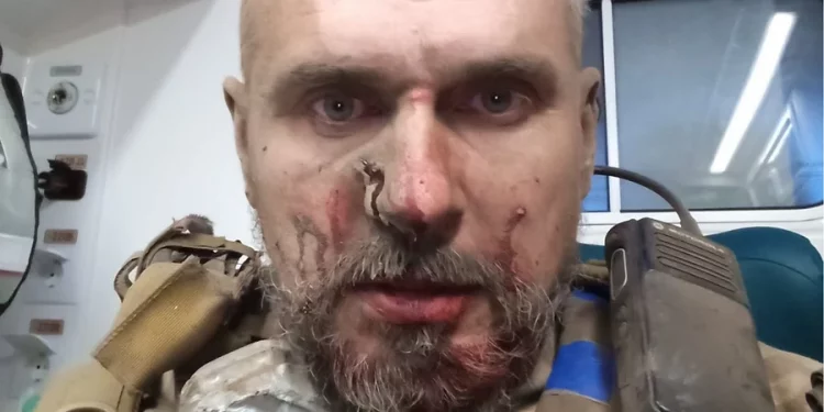 Олег Сенцов отримав поранення на фронті