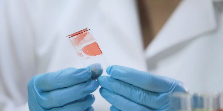 Випадок гепатиту А зафіксували на Тернопільщині!