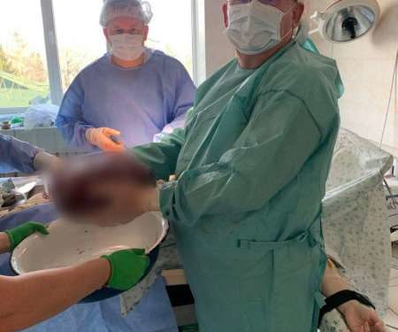 Величезну пухлину видалили жінці тернопільські лікарі