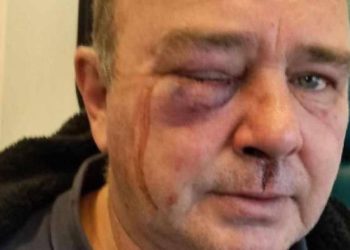 ЗМІ поширюють інформацію щодо побиття працівниками ТЦК чоловіка