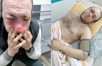 Потерпілий Орест Паньків. Фото Суспільного