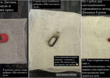 Предмети зі шлунків дітей