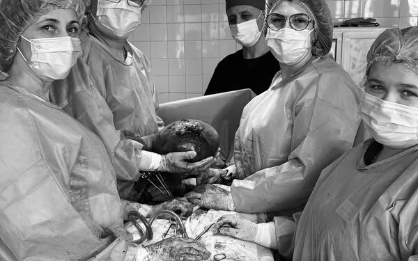 У перинатальному центрі зробили надскладну операцію