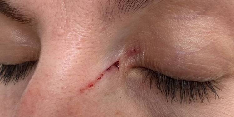 Чоловік з психічним розладом вдарив жінку