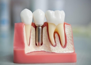 Хто з тернополян має право на безкоштовне зубопротезування